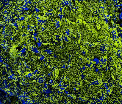 Cell surrounded by viral particles