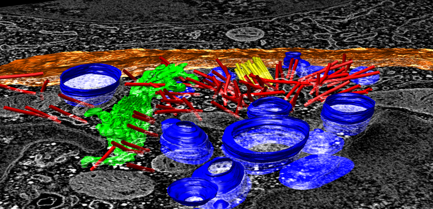 electron tomography of human immune T-cell
