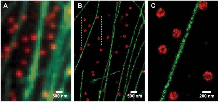 comparison of cell structure resolution