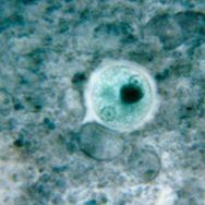 Entamoeba histolytica in cyst form