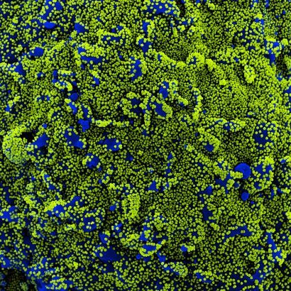 Cell surrounded by viral particles 