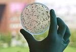 petri dish