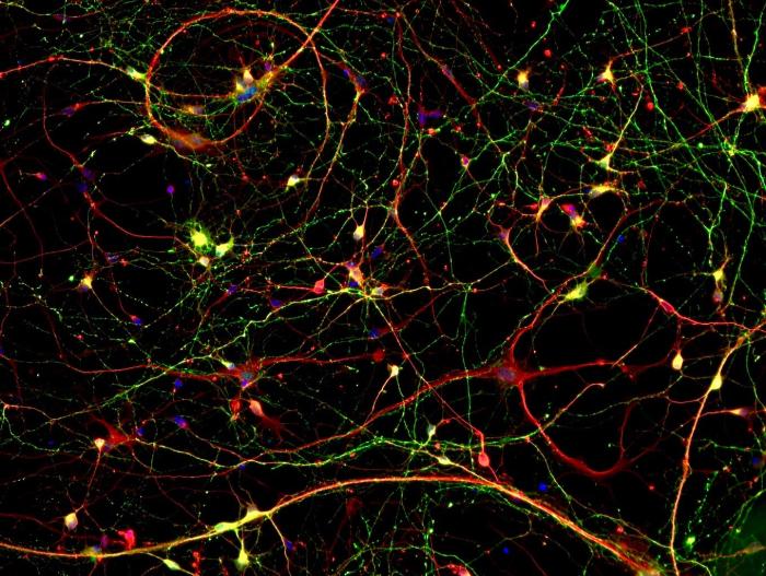 Neurons in petri dish